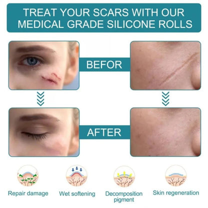 Silicone Scar Removal Sheet
