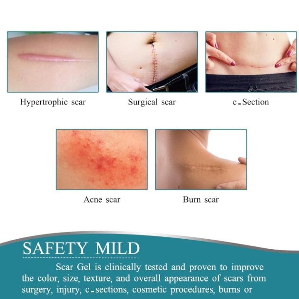 Silicone Scar Removal Sheet