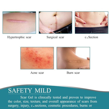 Silicone Scar Removal Sheet
